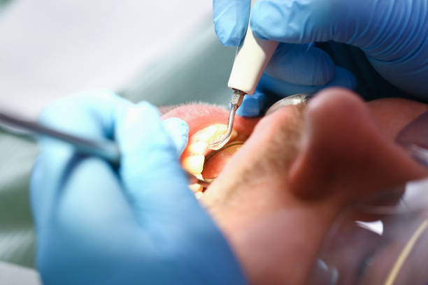 Best Walk-In Emergency Dentist in Cherry Valley, CA